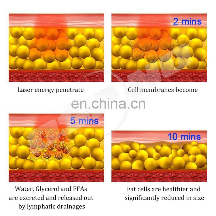 Best new product CE approved fast slimming machine lipolaser fat loss beauty equipment