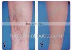 Professional Two handles ipl/rf hair removal machine