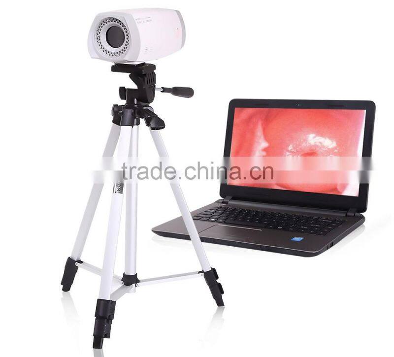Portable Digital Electronic Colposcope in cheap price