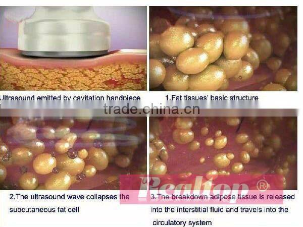Fast cavitation slimming system manual ultra slim sonic cellulite reduction machine ultrasound facial lymphatic drainage machine