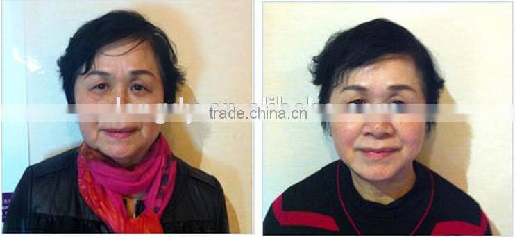 Factory direct selling Low price 3 head pieces 1.5mm&3.0mm&4.5mm hifu face machine anti-aging machine