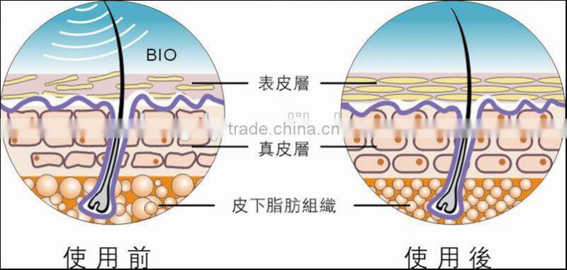 multifunction home use beauty machine for clean face, anti-aging, wrinkle removal