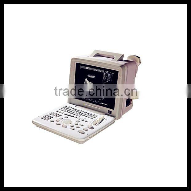 (Pregnant week,fetal weight,volume.etc) Both use in human and animal new portable laptop ultrasound machine/scanner/system price