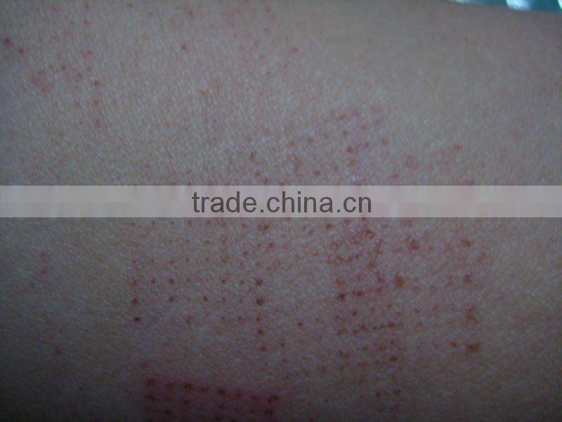 facial rejuvenation beauty equipment