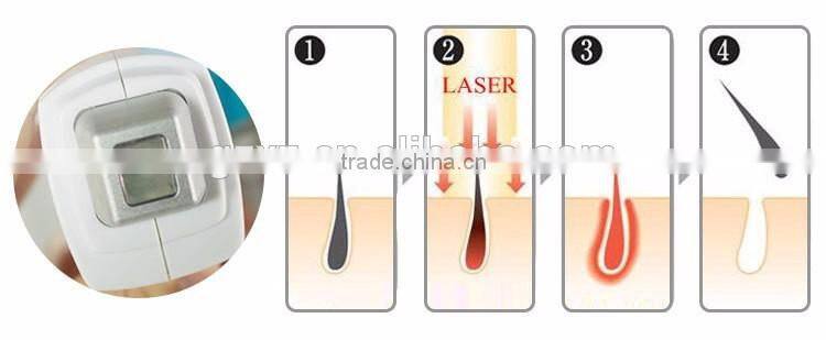 2016 CE Approved Non invasive 808nm diode laser hair removal price /permanent hair removal machine for sale