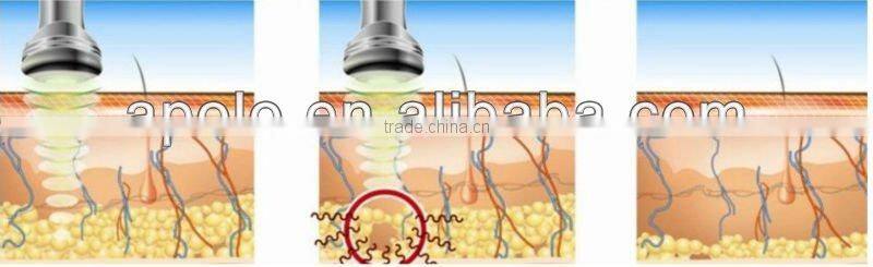 Effective RF wrinkle removal anti aging beauty equipment