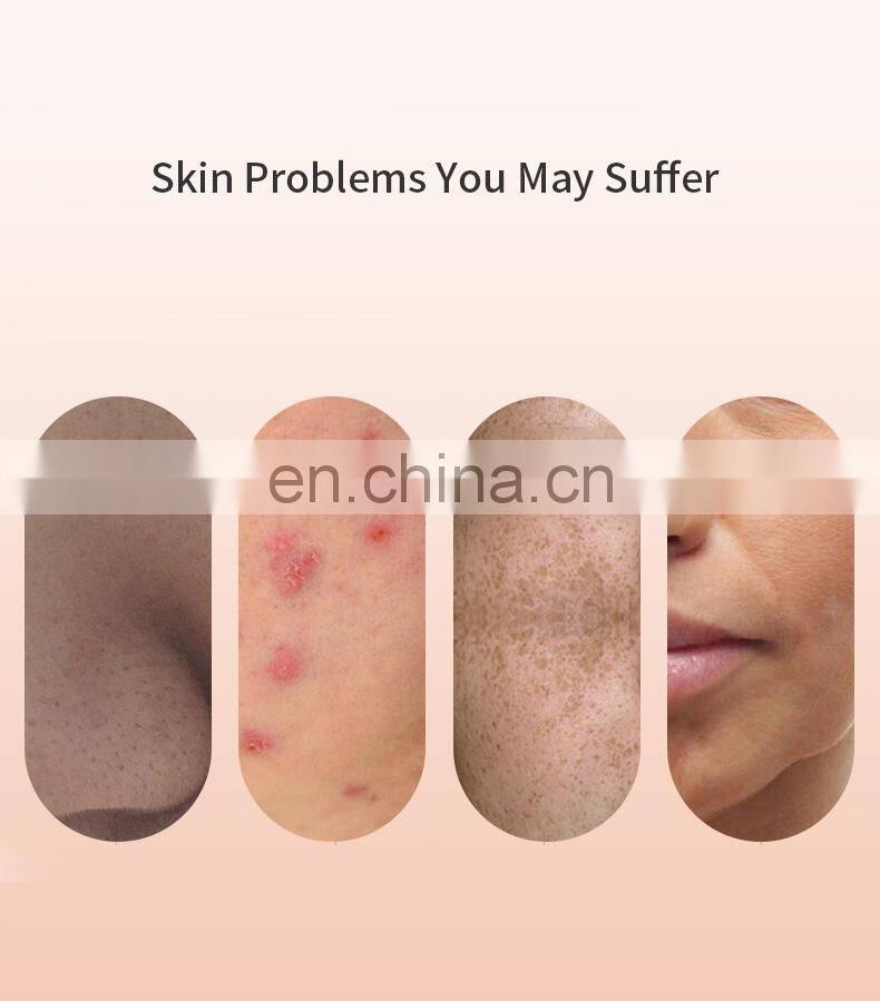 Free Sample Blackhead Remover Set Electric Microdermabrasion Machine with 6 Replacement Probes to Clear Acne Comedone