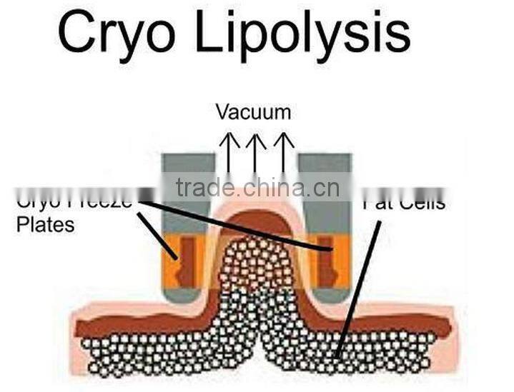 fat removal cryo slimming machine/cryo machine