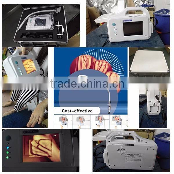 YSVV200 Good quality medical mobile simple operation vein light finder for sale