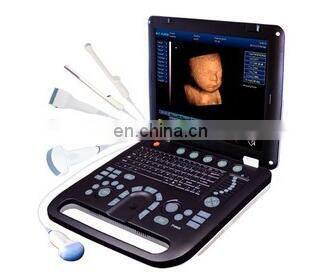 Medical diagnostic system cheaper Portable BW 3D 4D Live ultrasound Scanner Machine