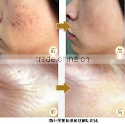 2015 Wholesale 192 needles ZGTS Titanium micro needle golden derma roller system