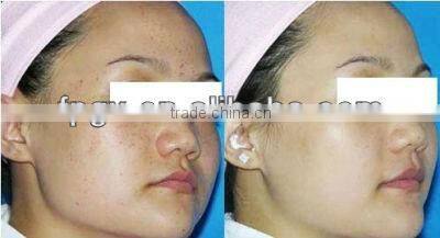 New Arrival IPL SHR Skin Rejuvenation RF Anti Wrinkle 2in1 Beauty Machine