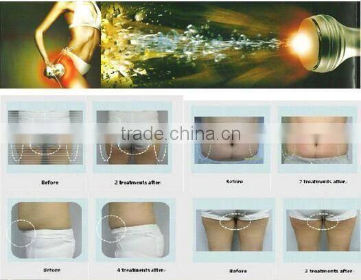 kim 8 new cavitation rf vacuum slimming machine