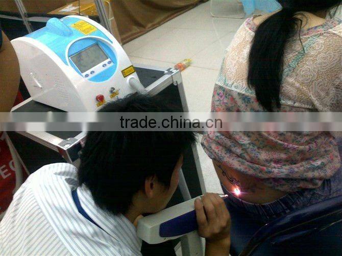 (2013 Hot sales) MINI pigment removal tattoo removal laser machine OB-TR 03