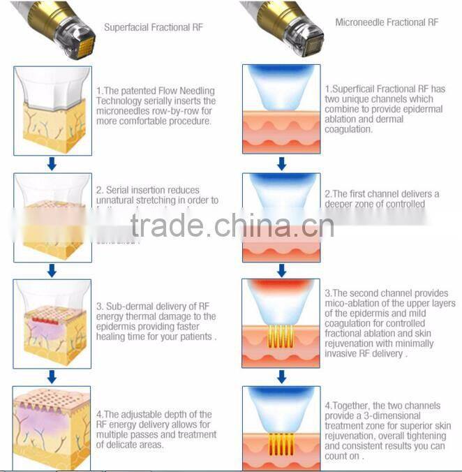 Salon use 5MHZ RF skin tightening face lifting beauty machine monopolar rf machine