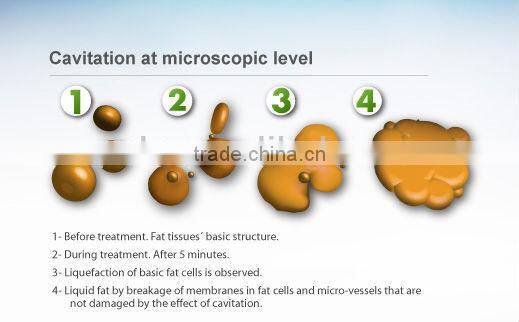 New slimming system Apolomed HS-530RV Cellulite Removal
