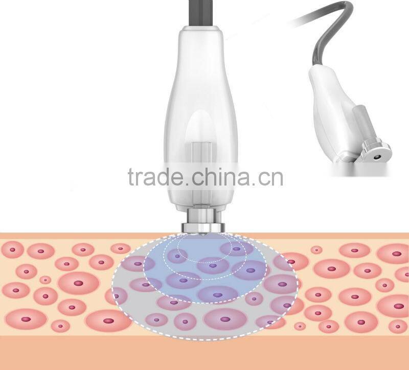 Cyclone Shape - The Best Weight Loss Cyclone rf Beauty Machine