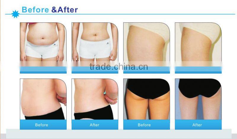 Cavitation Body Contouring cavitation rf machine/Cavitation Machine with CE approved-SINERON-II