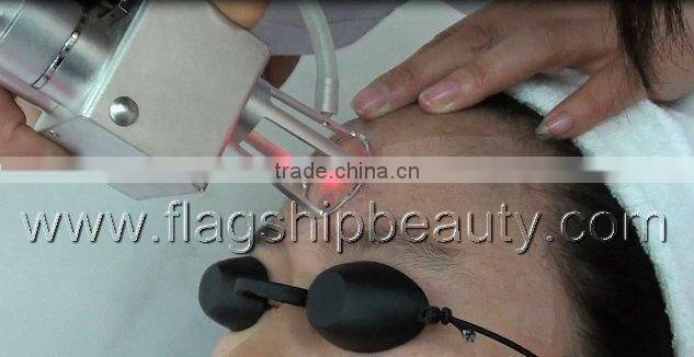 rf co2 fractional laser scar removal stretch mark removal