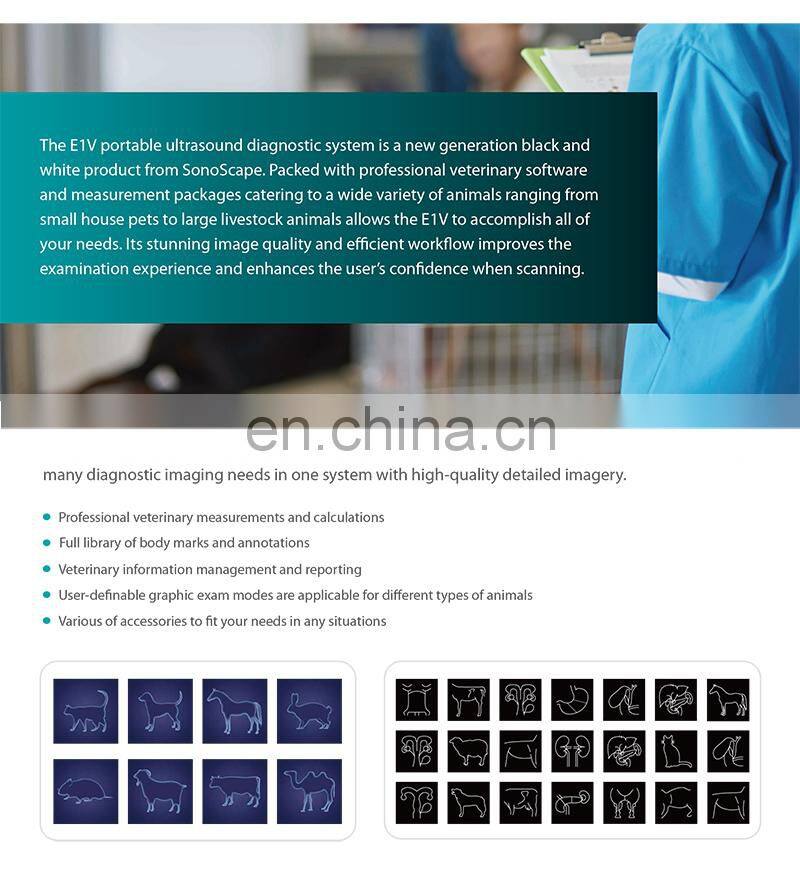 Factory price ultrasound device Price / New Released Sonoscape Vet Ultrasound E1V