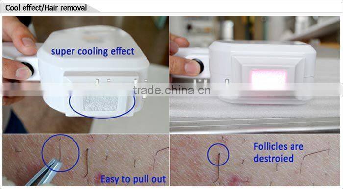 Hot selling 10 laser bars TEC condenser 808nm permanent hair removal laser depilator home