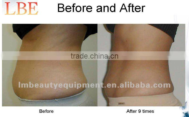 air pressure leg massage machine