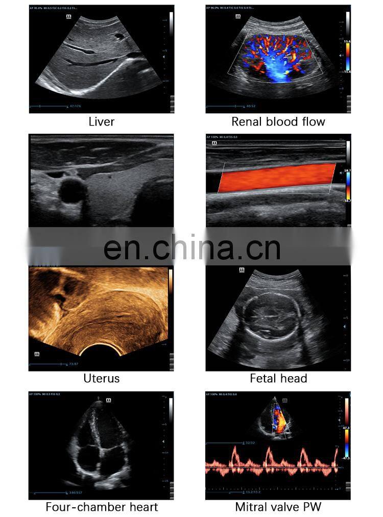 Mindray DC-30 ultrasound equipment/Mindray color doppler ultrasound