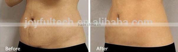 kim 8 new cavitation rf vacuum slimming machine