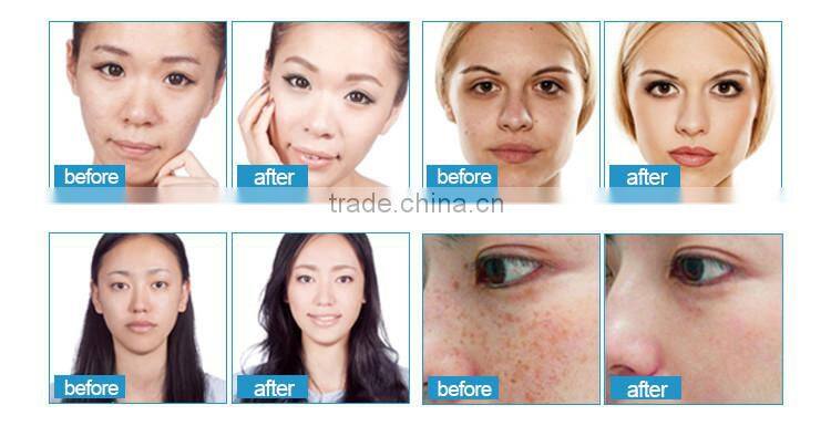 4 led light facial therapy PDT multifunction beauty machine for sale
