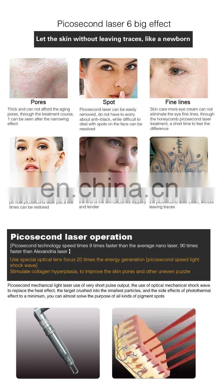 Amazing!!!Safe and Effective eliminates spots tattoo removal picosecond laser machine for sale