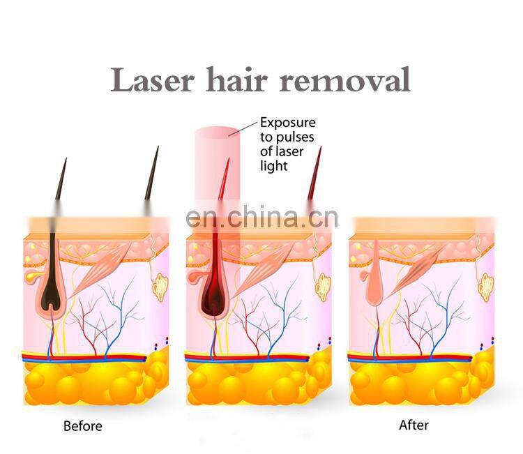 Medical Portable and Vertical Cosmetic Beauty Machine 808 Diode Laser For Women Or Man