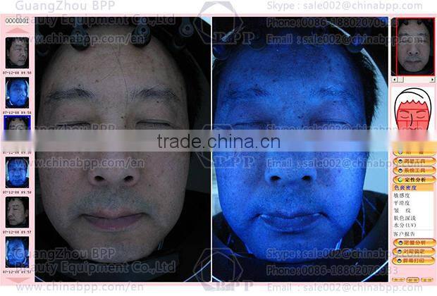 2015 Hot uv light facial skin analysis machine for speckles analysis