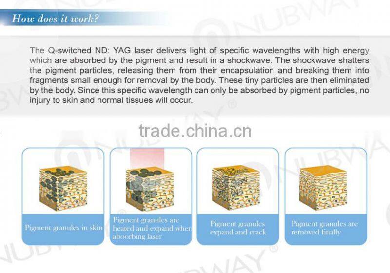 New design !! 1064 nm 532nm nd yag laser/long pulse nd yag laser