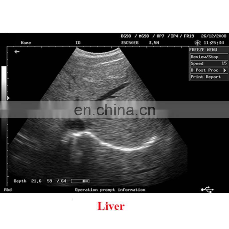 Hot Sales Original Mindray DP-2200PLUS Portable Full digital ultrasound machine /mindary ultrasound