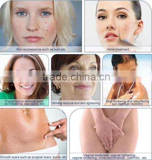 EAG & Co2 fractional laser for vaginal tightening