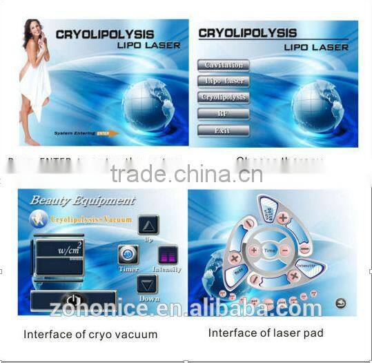 BD06C Portable cryolipolysis fat freeze slimming machine