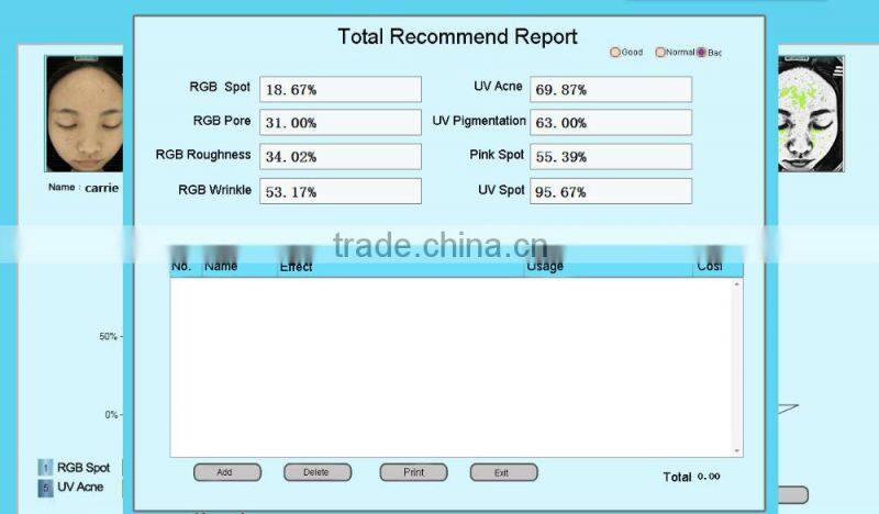 Best sell UV light skin scanner machine detect deep skin moisture content