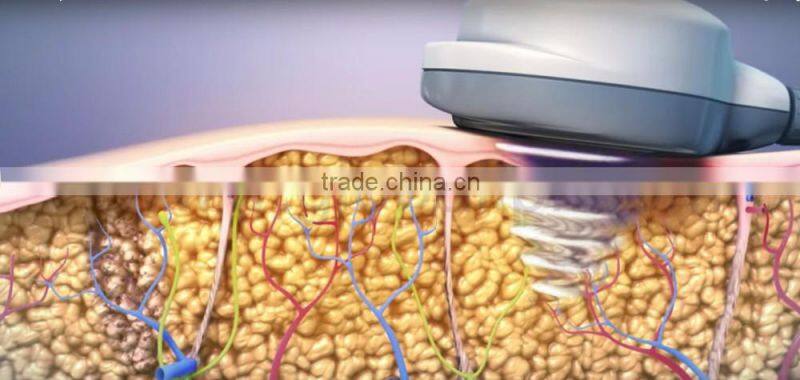 Vertical body slimming ultrashape cavitation beauty machine