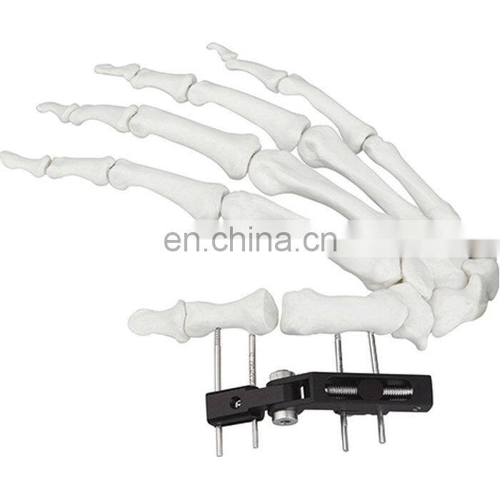 CE & ISO Marked Mini Fragment External Fixator (Finger and Palm) Surgical Instrument