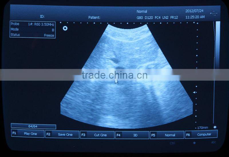 CE Mark Medical Equipment Portable ultrasonic/Cheapest ultrasounic Scanner/Machine 3.5Mhz multi-frequency Convex Probe-Shelly