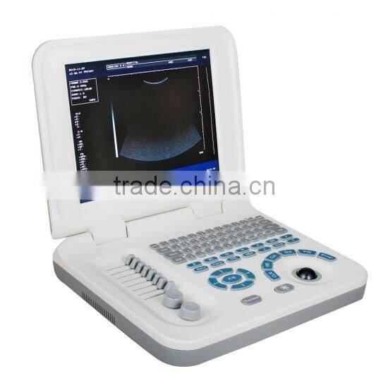 Full Digital Laptop B&W ultrasound system Ultrasound Scanner Ultrasound machine