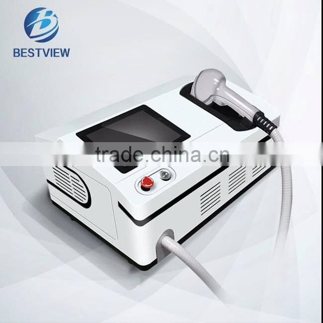 High quality professional laser hair removal machine 808nm diode