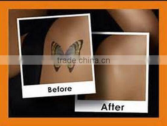 cheap q switch nd yag tattoo removal laser machine with top quality and medical ce approval