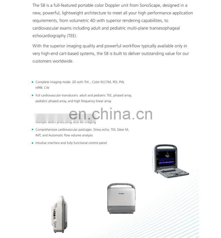 Sonoscape S8 portable color doppler ultrasound scanner sonoscape ultrasound machine S8