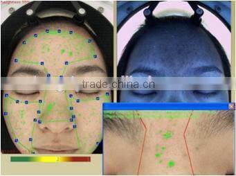 CE Approval 1 years warranty magic mirror facial skin analyzer