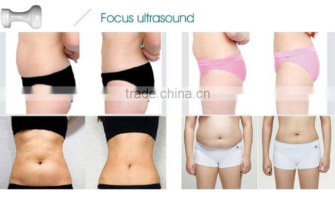 fast slimming Focused ultrasound body slimming system ultrasonic mach cellulite reduce body shaper slimming machine