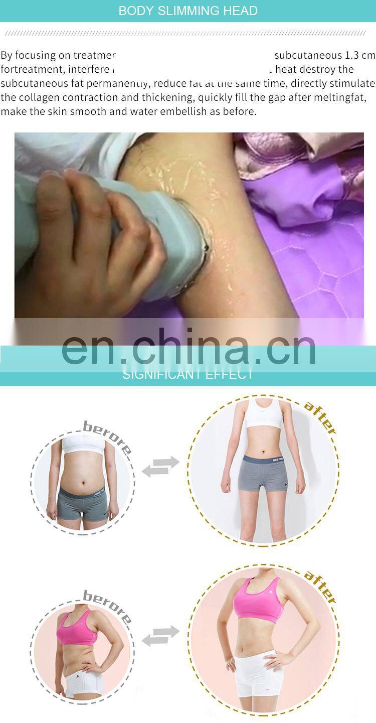 Portable Ultrasound Hifu Slimming Machine for Body Weight Loss