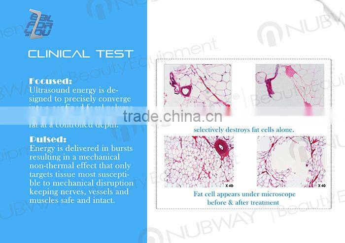 CE approved HIFU slimming machine / cavitation focus slimming machine / HIFU beauty machine