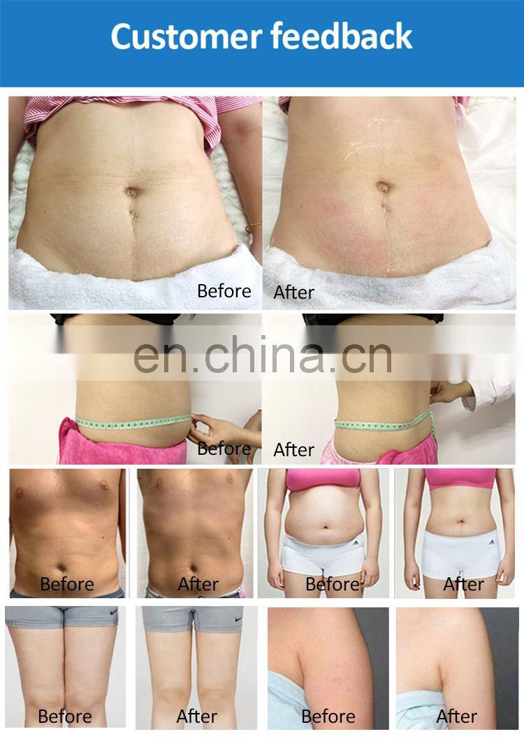 2022 6D laser slimming Weight Loss Shape body shaping red 635nm Wavelength cryo Laser EMS Therapy Fat Removal Machine with CE