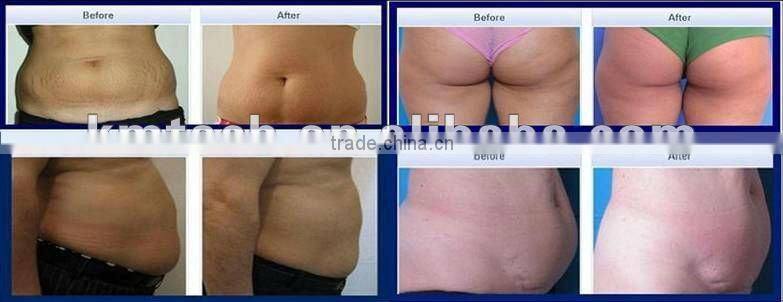 Professional 4s cavitation radiofrecuencia facial machine